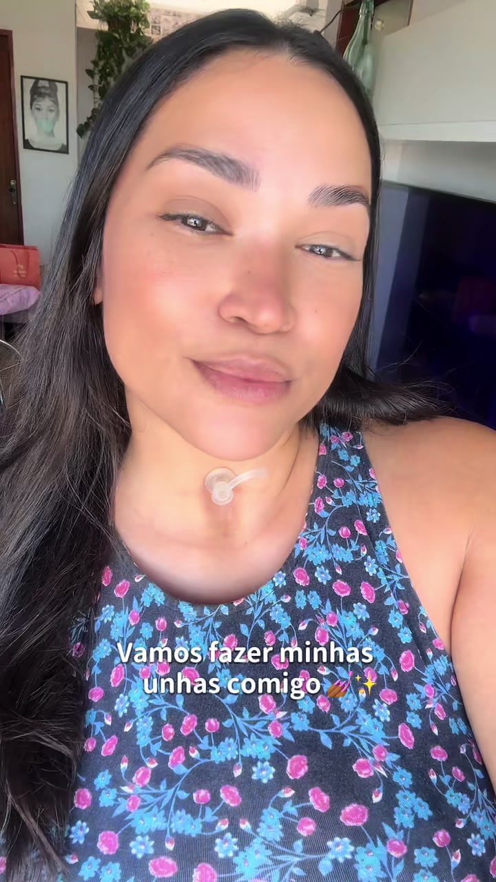 @Chay