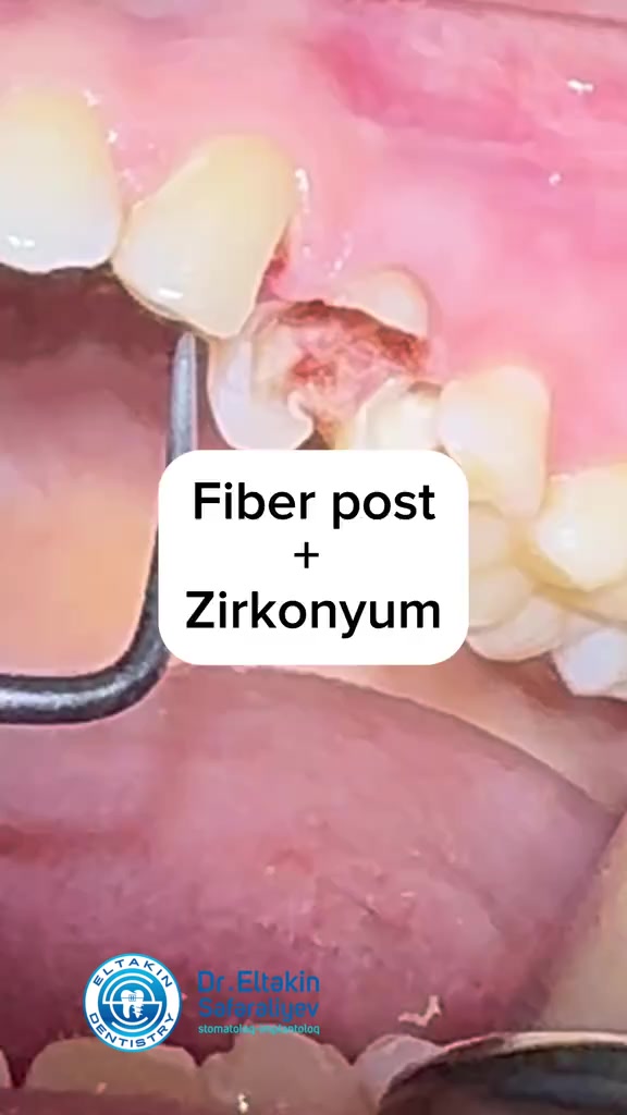 @eltakindentistry