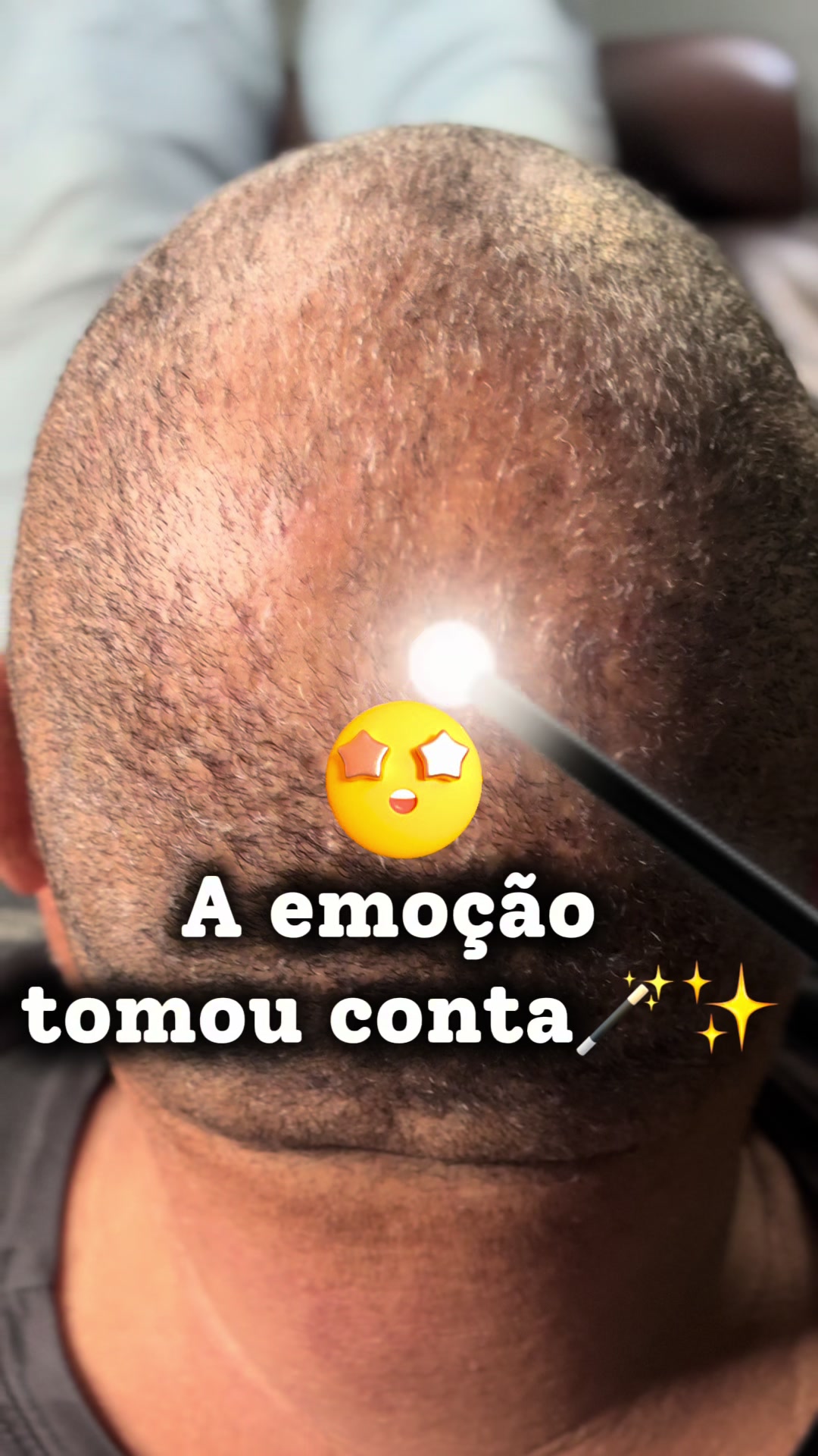 @Valesca Abi Ackel Scalp