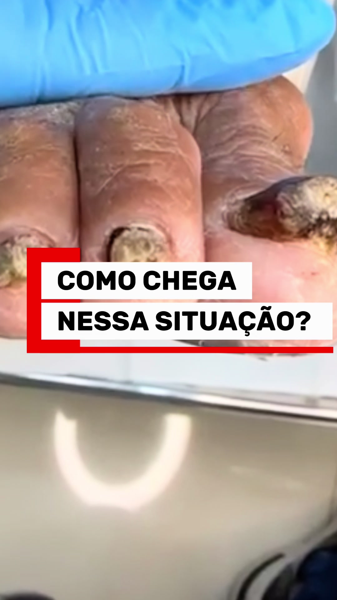 @Podocurebr