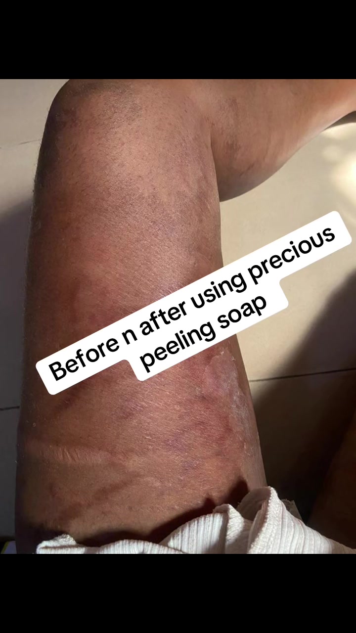 @@ Precious peeling soap