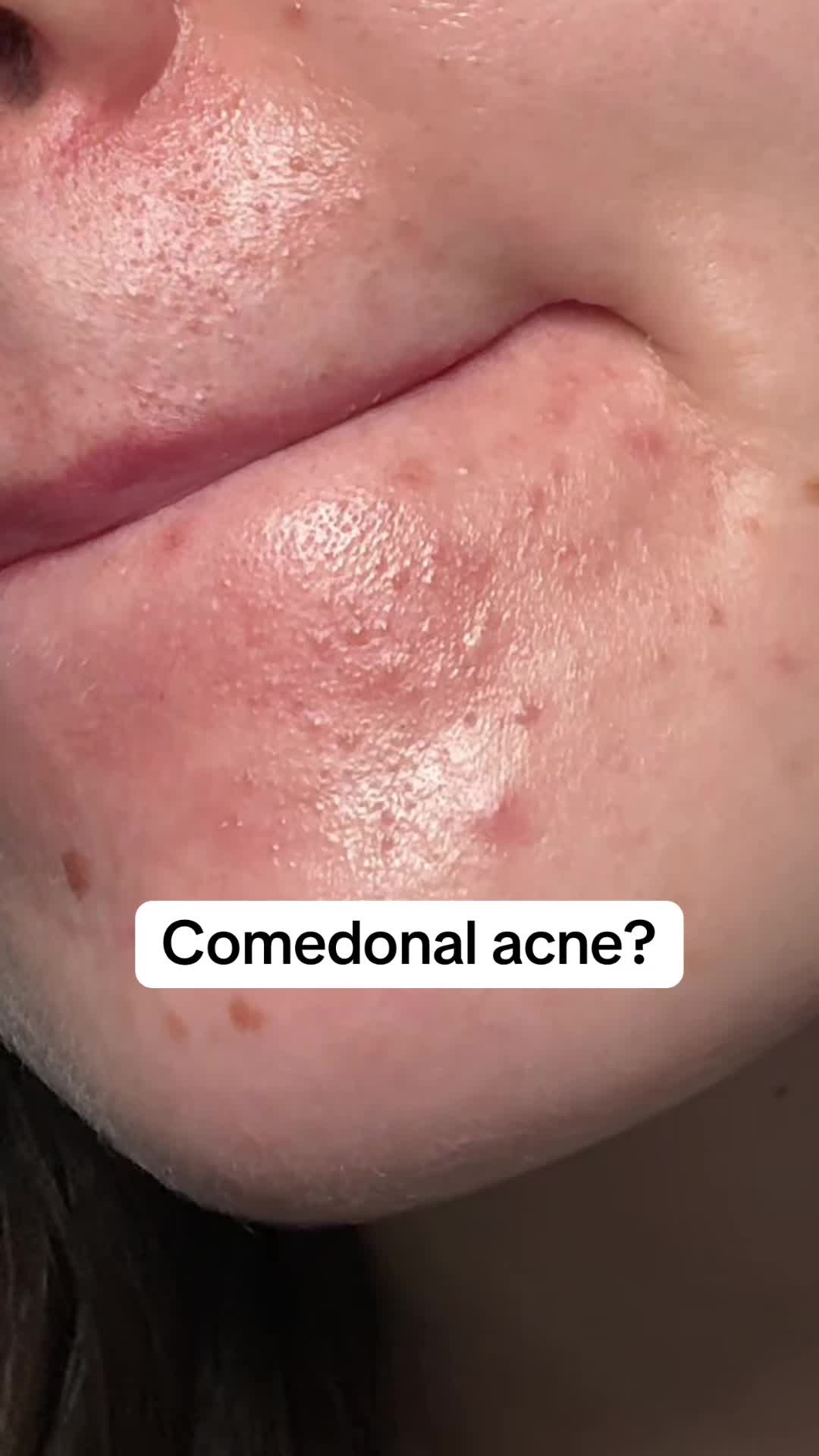 @watermelonsugarskin