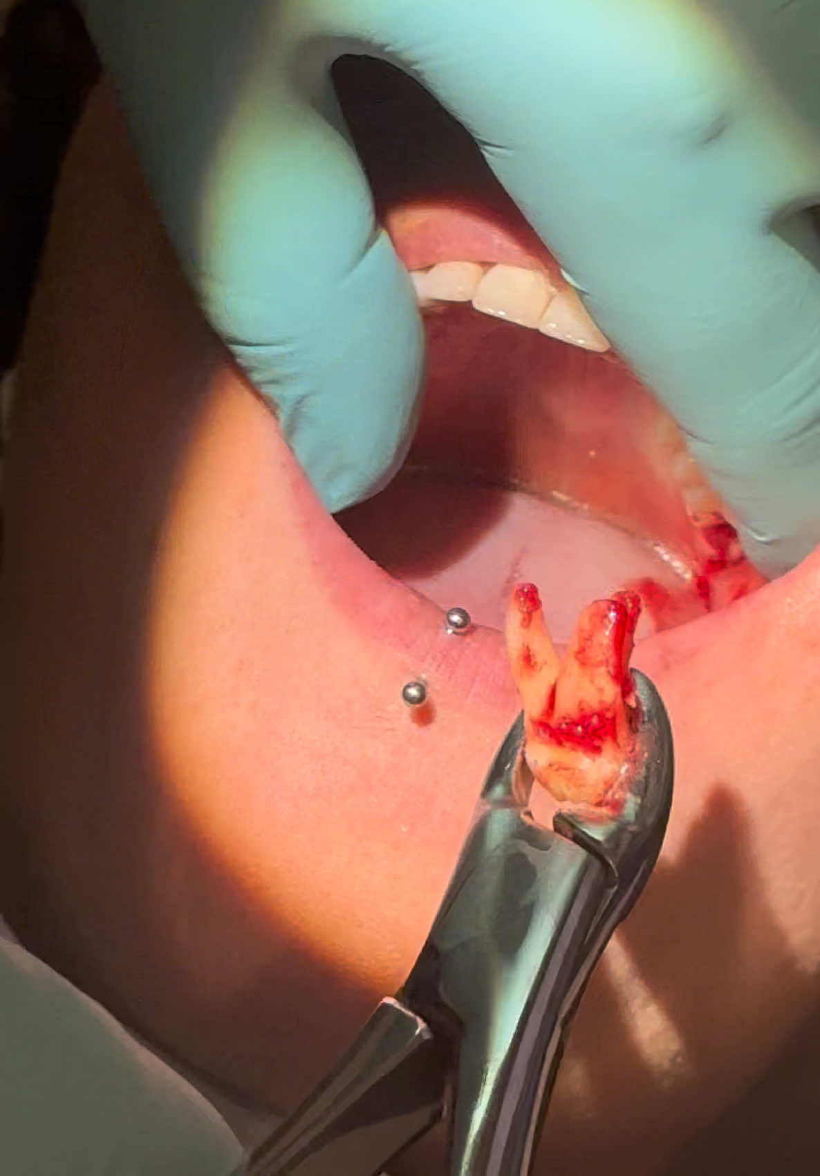 @Centers for Dental Excellence