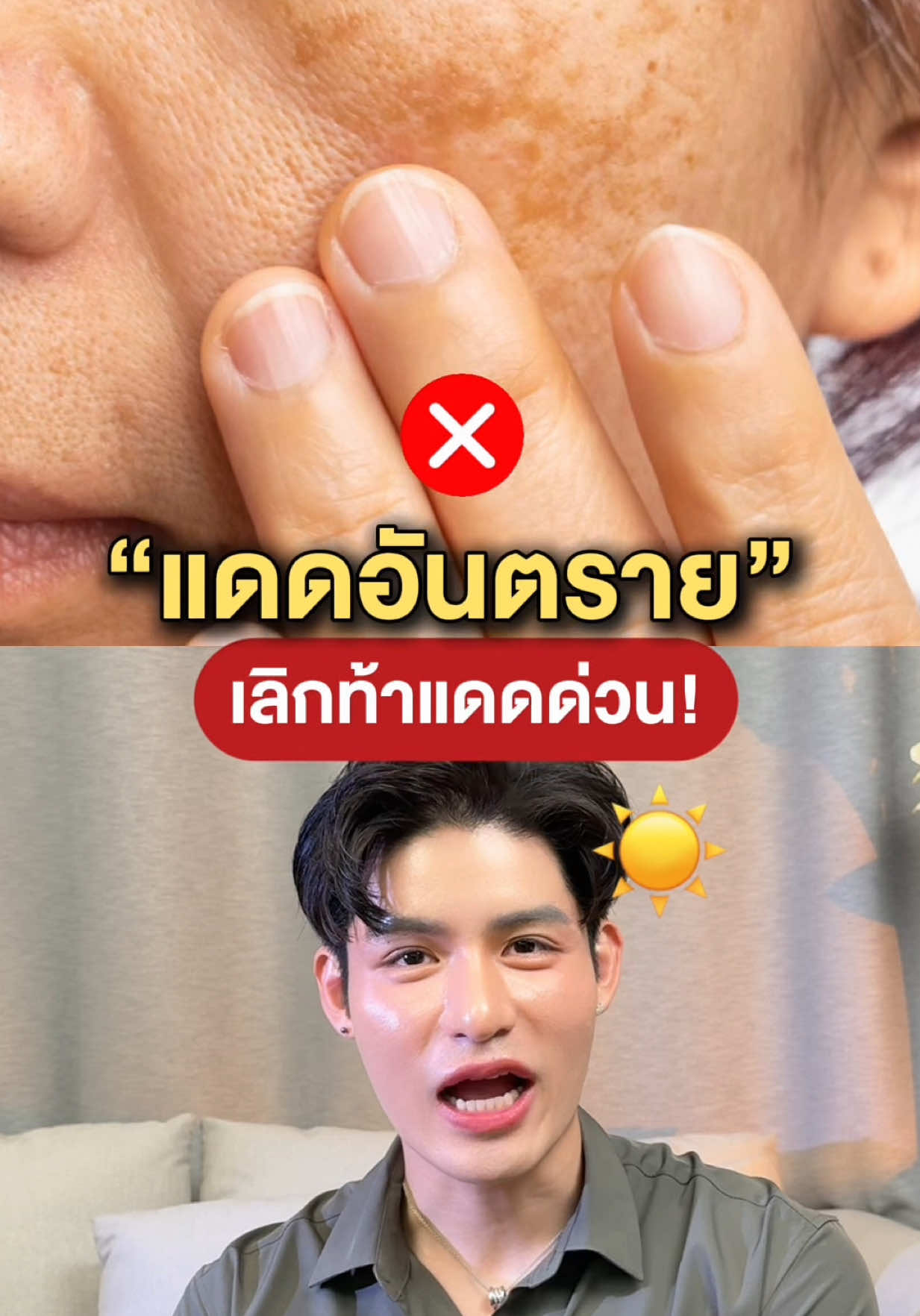 @หนูปอนด์ที่ชอบเลเซ่อร์