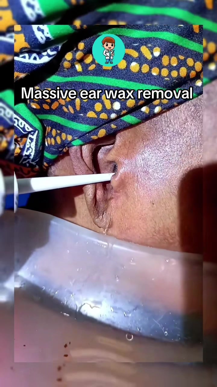 @Satisfying Ear Cleaning Videos