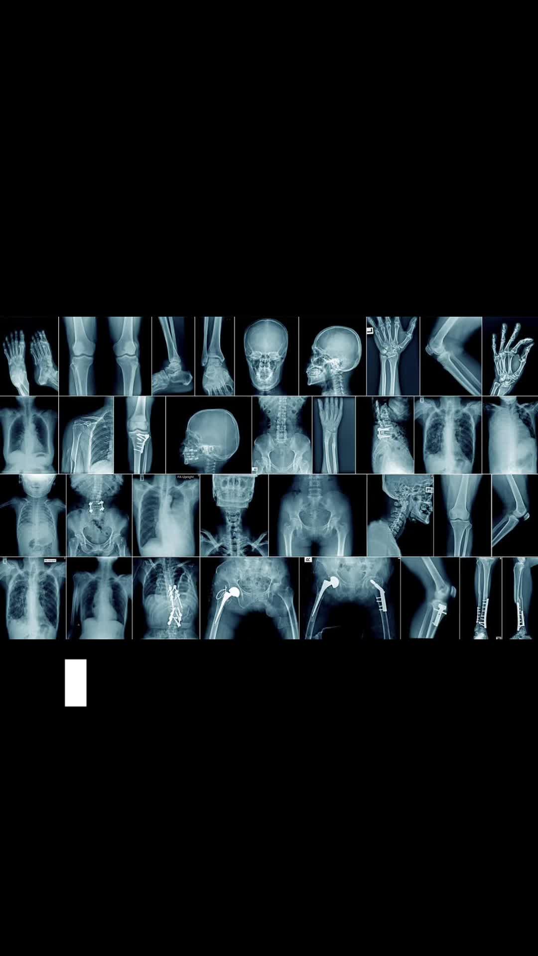 @๐๐ฑ๐ธ๐ป๐ แตฬโก