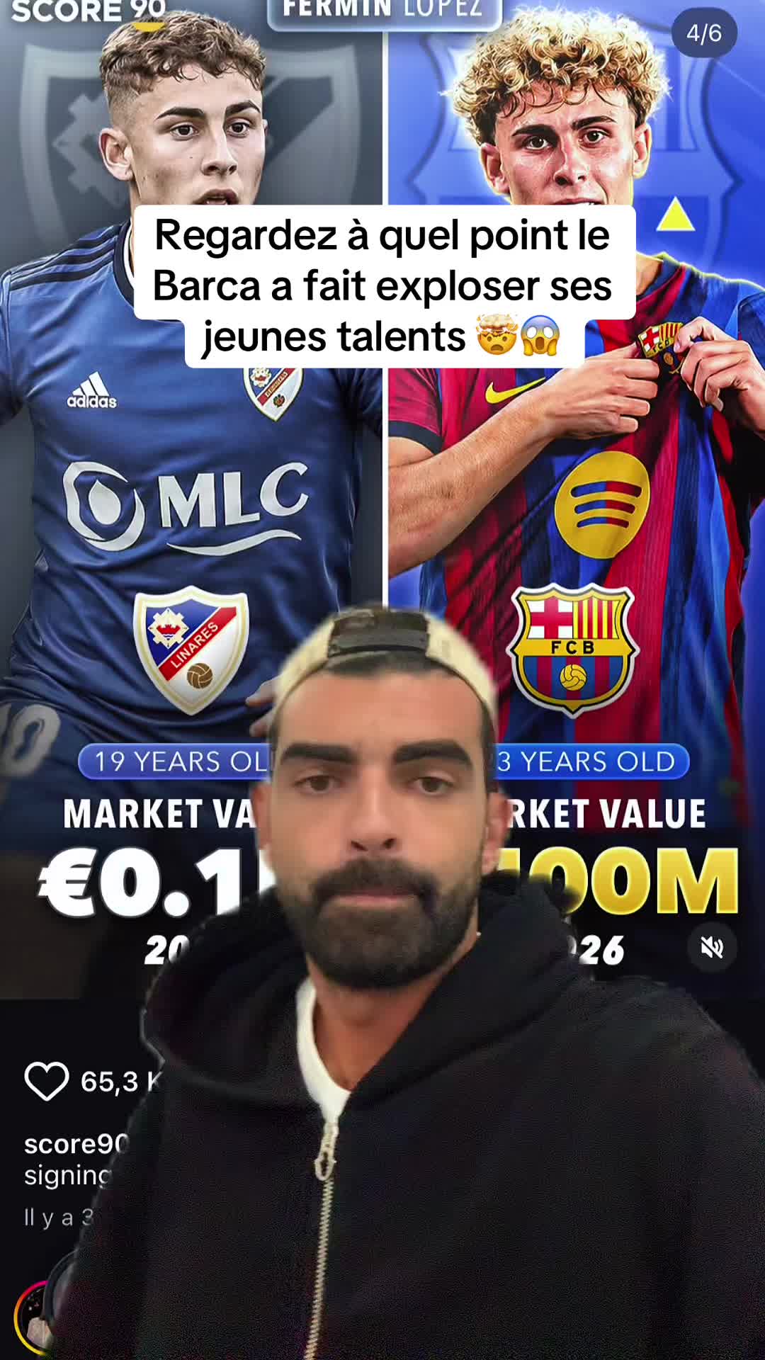 @Mikael Marciano