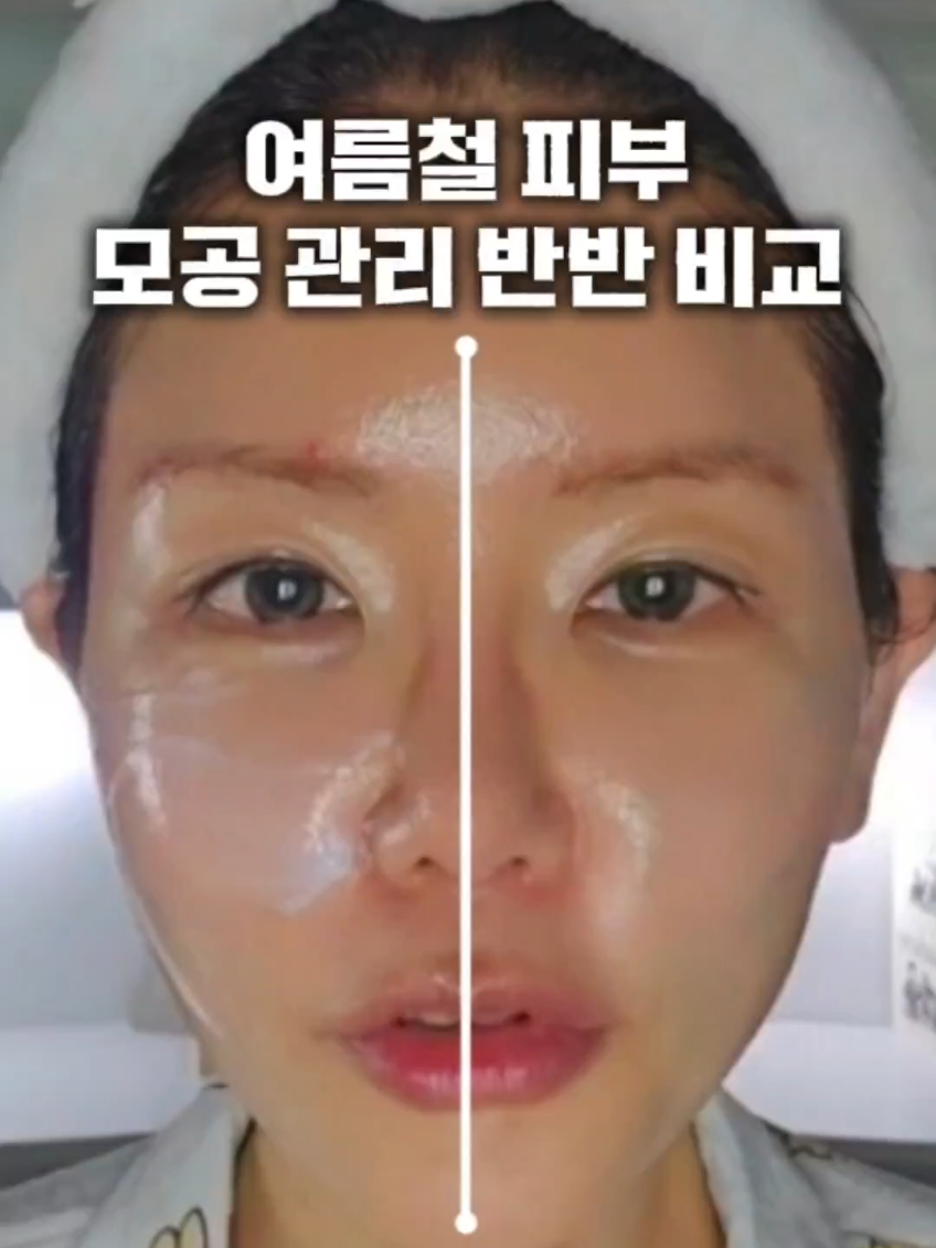 @지나스 GINAS