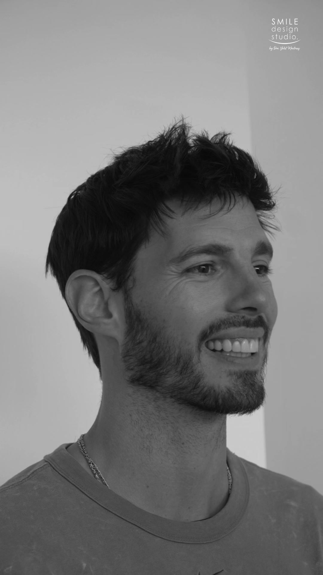 @SmileDesignStudio