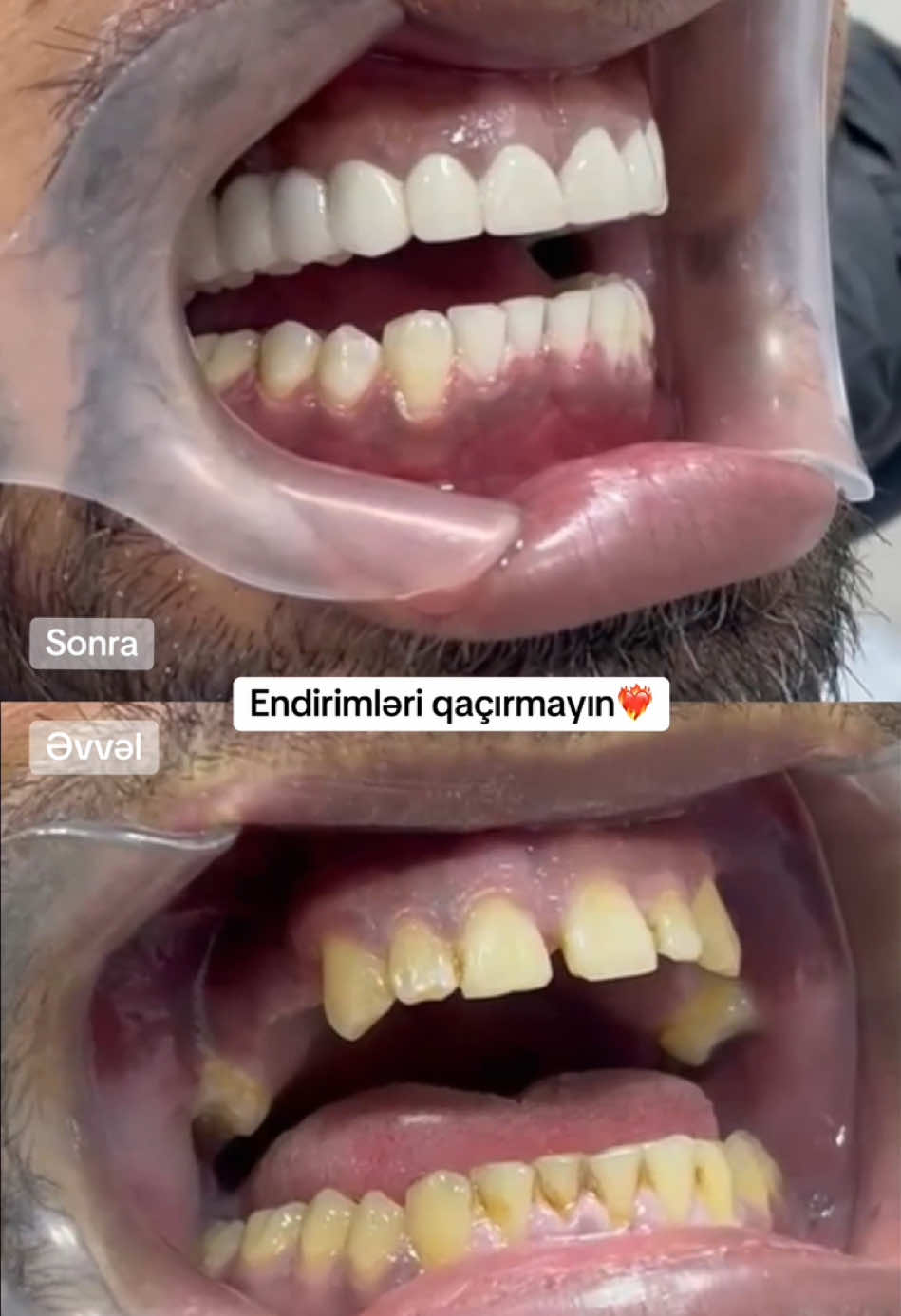 @Dr.Məhəmməd Məlikov