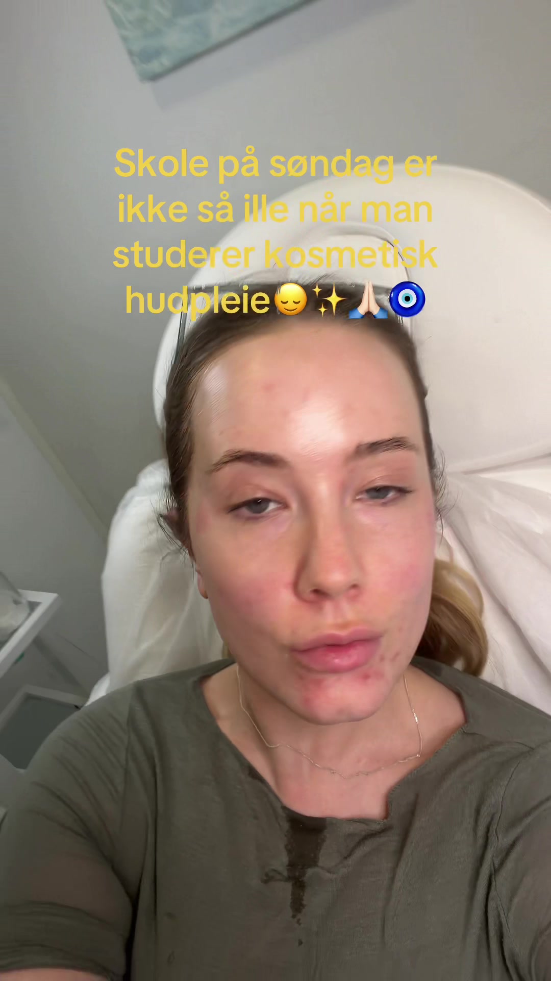 @BUNNY