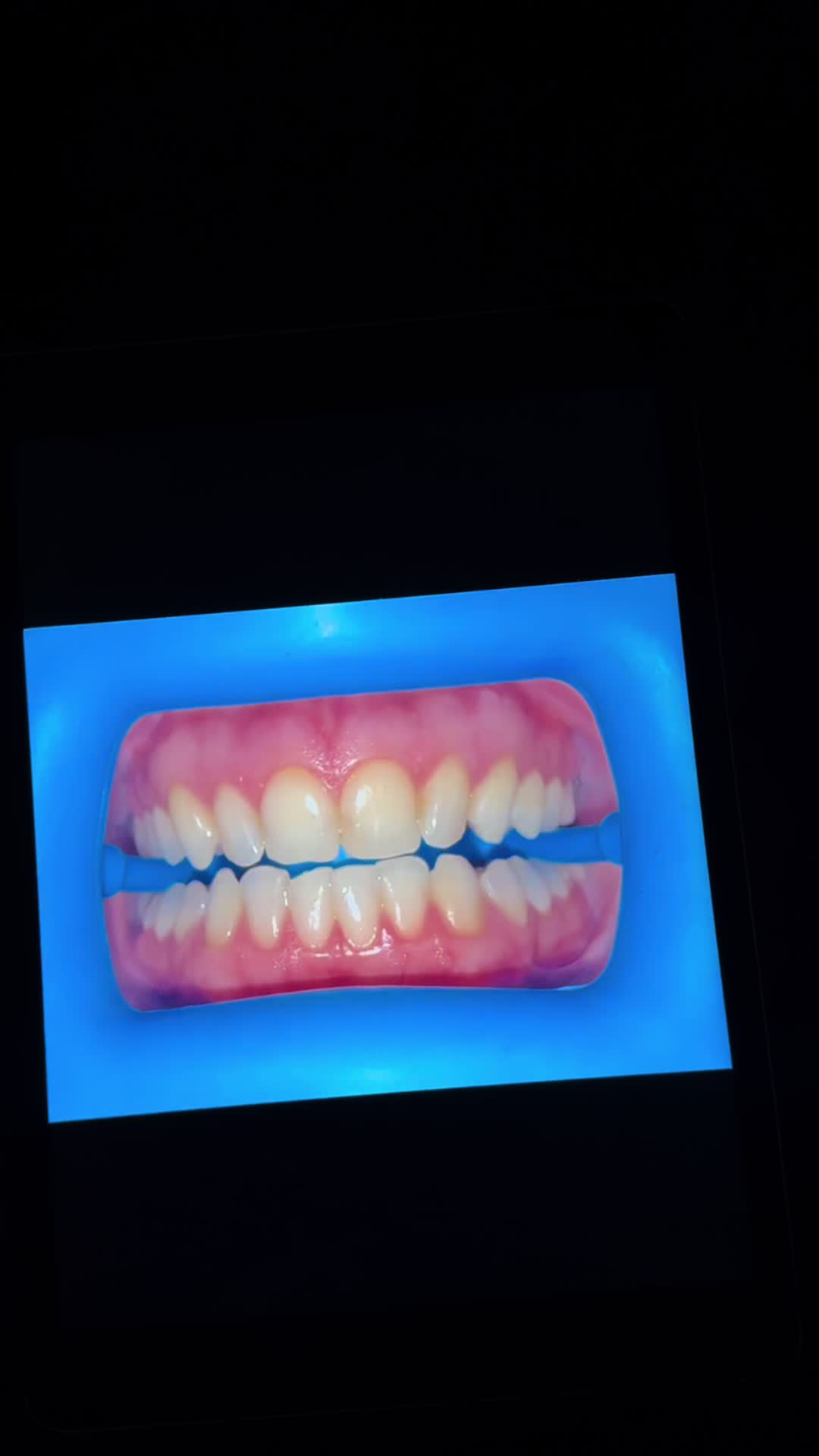 @Halal Teeth Whitening London
