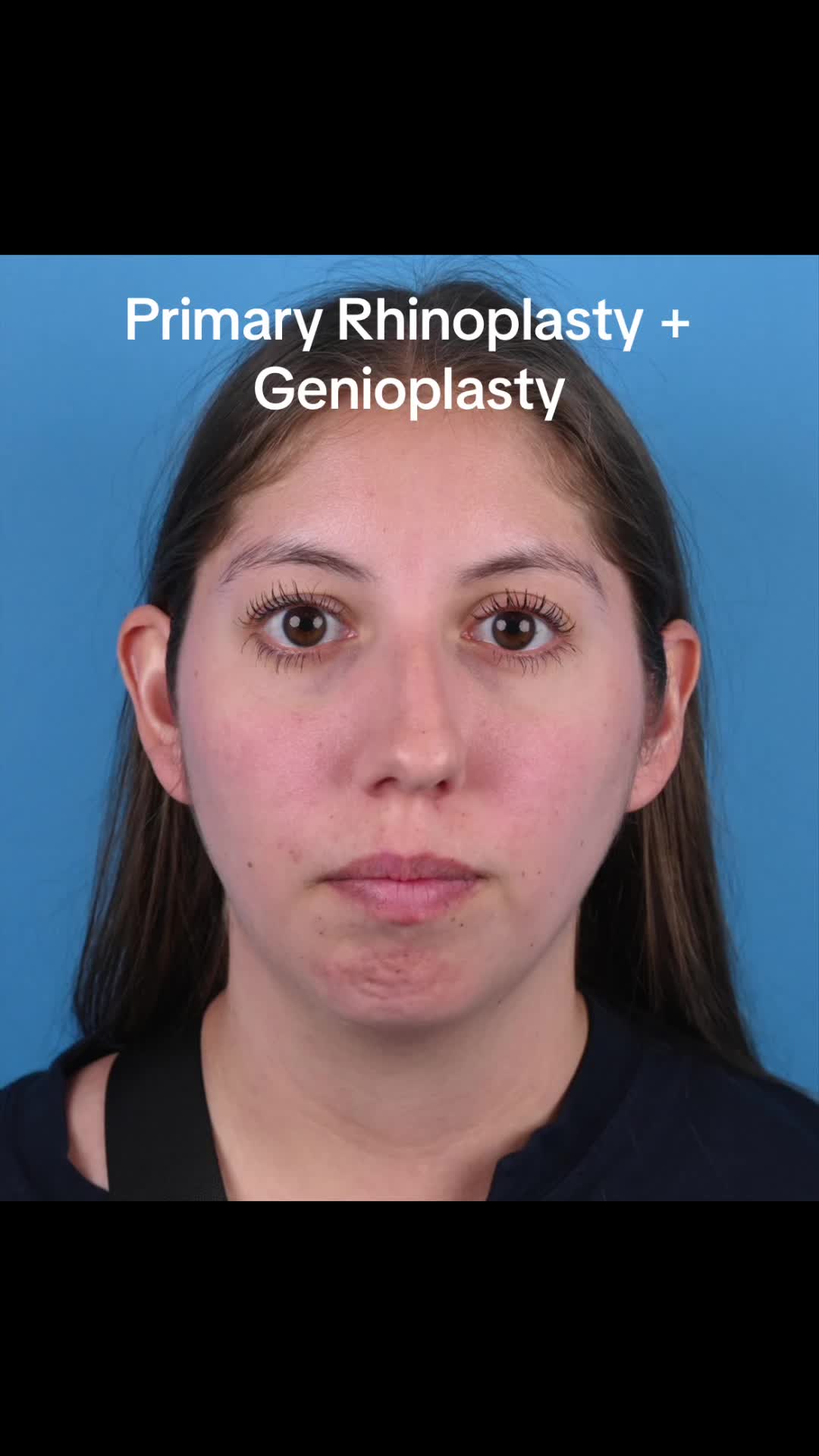 @Dr. Parit Patel, MD
