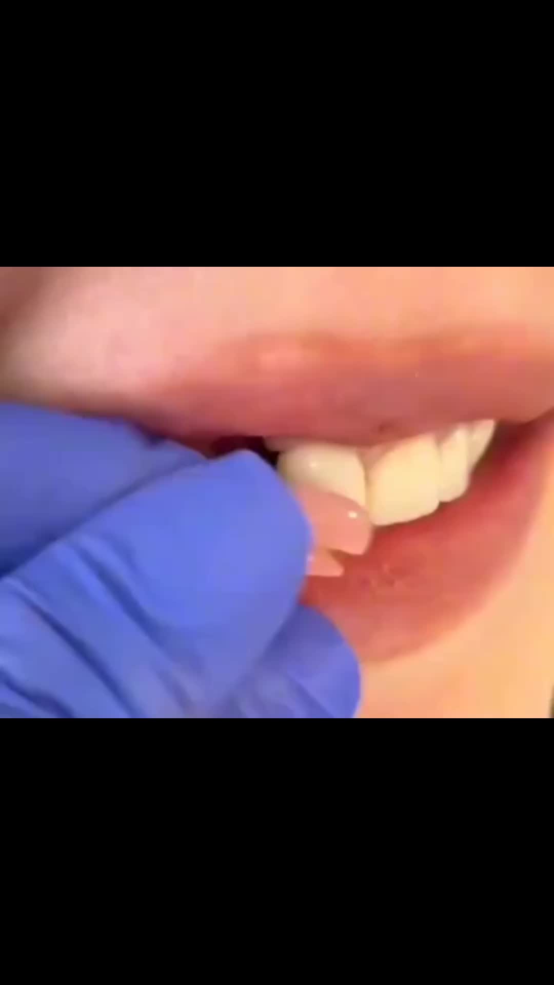 @Dr_sheraz_official 🦷
