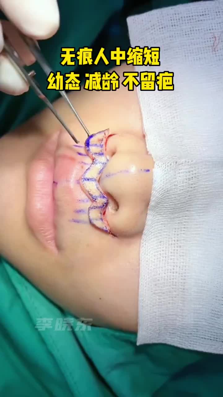 @Dr.HuJunJie