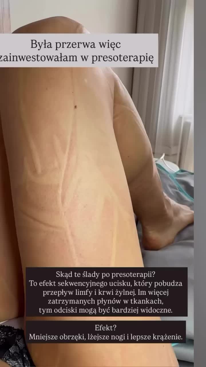 @Marta Szczepańska Regeneracja