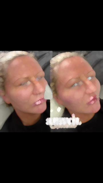 @Superfacial Aesthetics