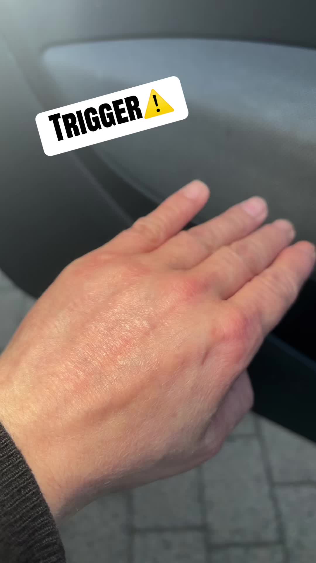 @GibdieHoffnungnichtauf🤘🏻🩵