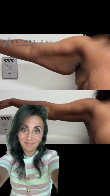 @AESTHETICA LA -Dr.Yaghoubian