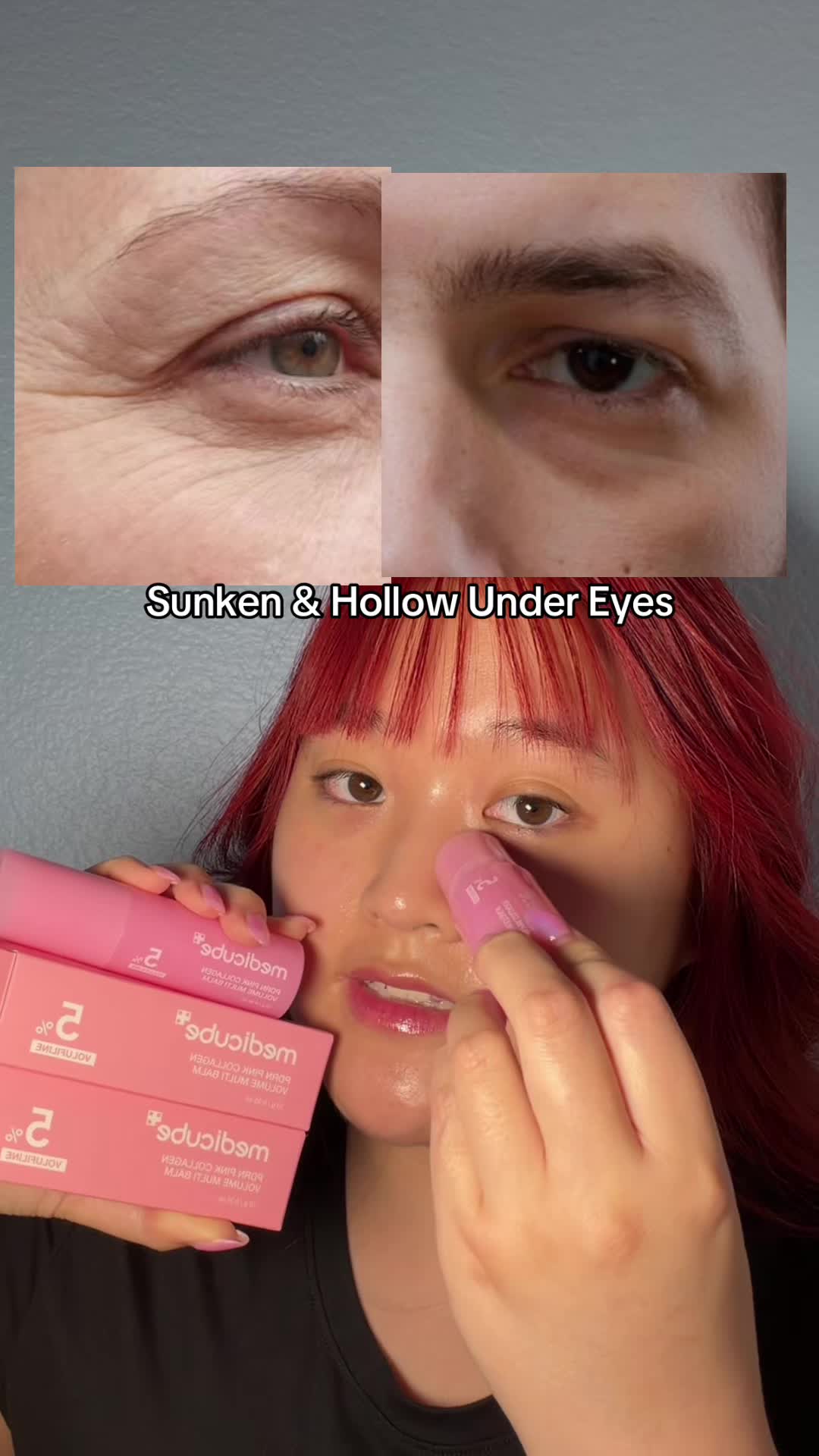 @Korean Skincare | Trish Trinh