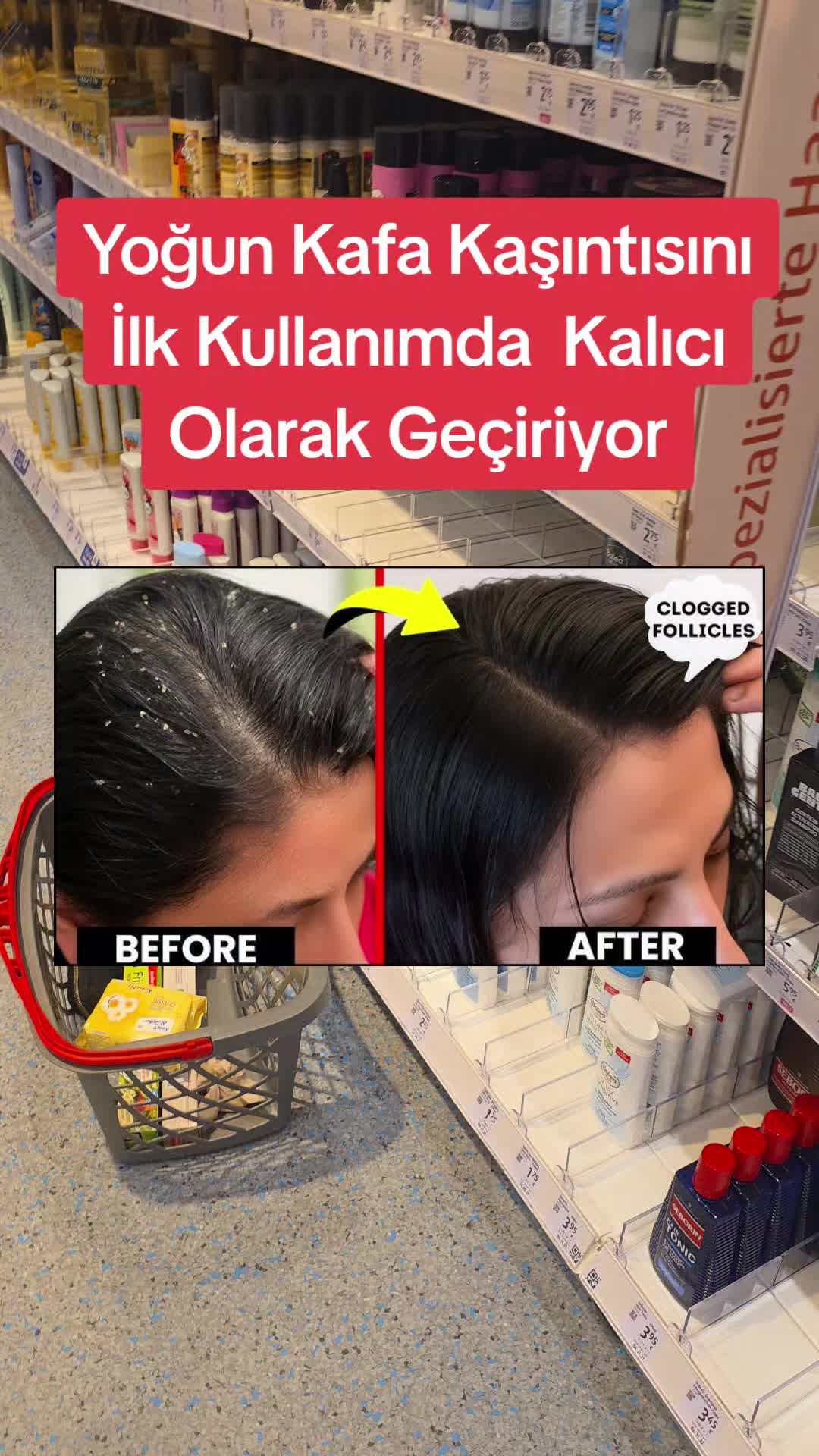 @Gurbetana27
