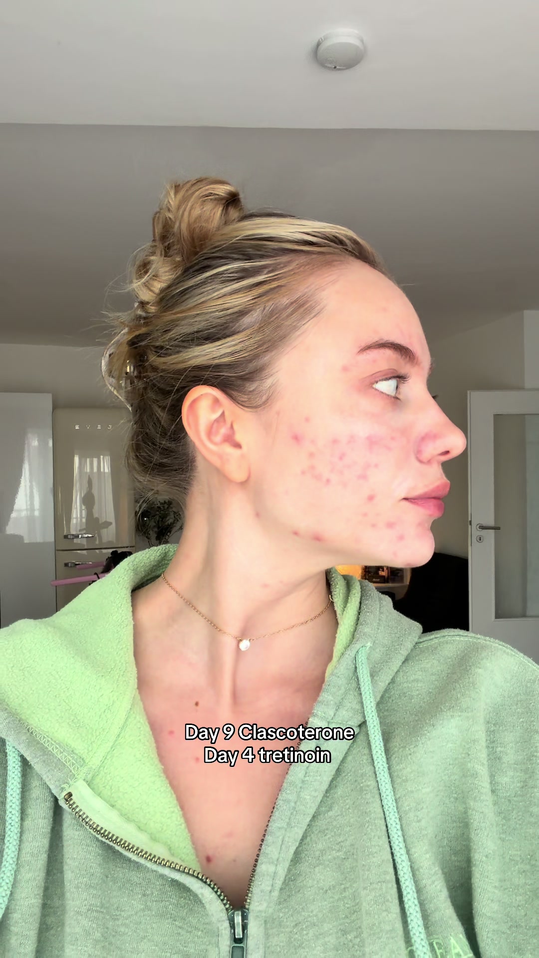 @enyadres