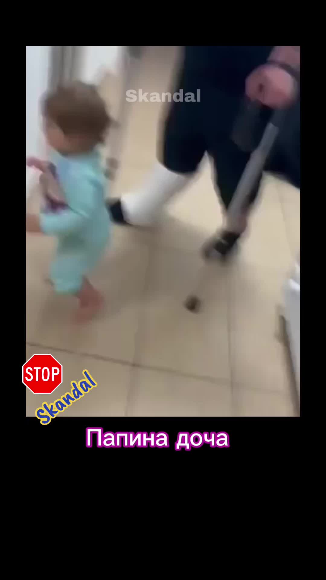 @skandal 2
