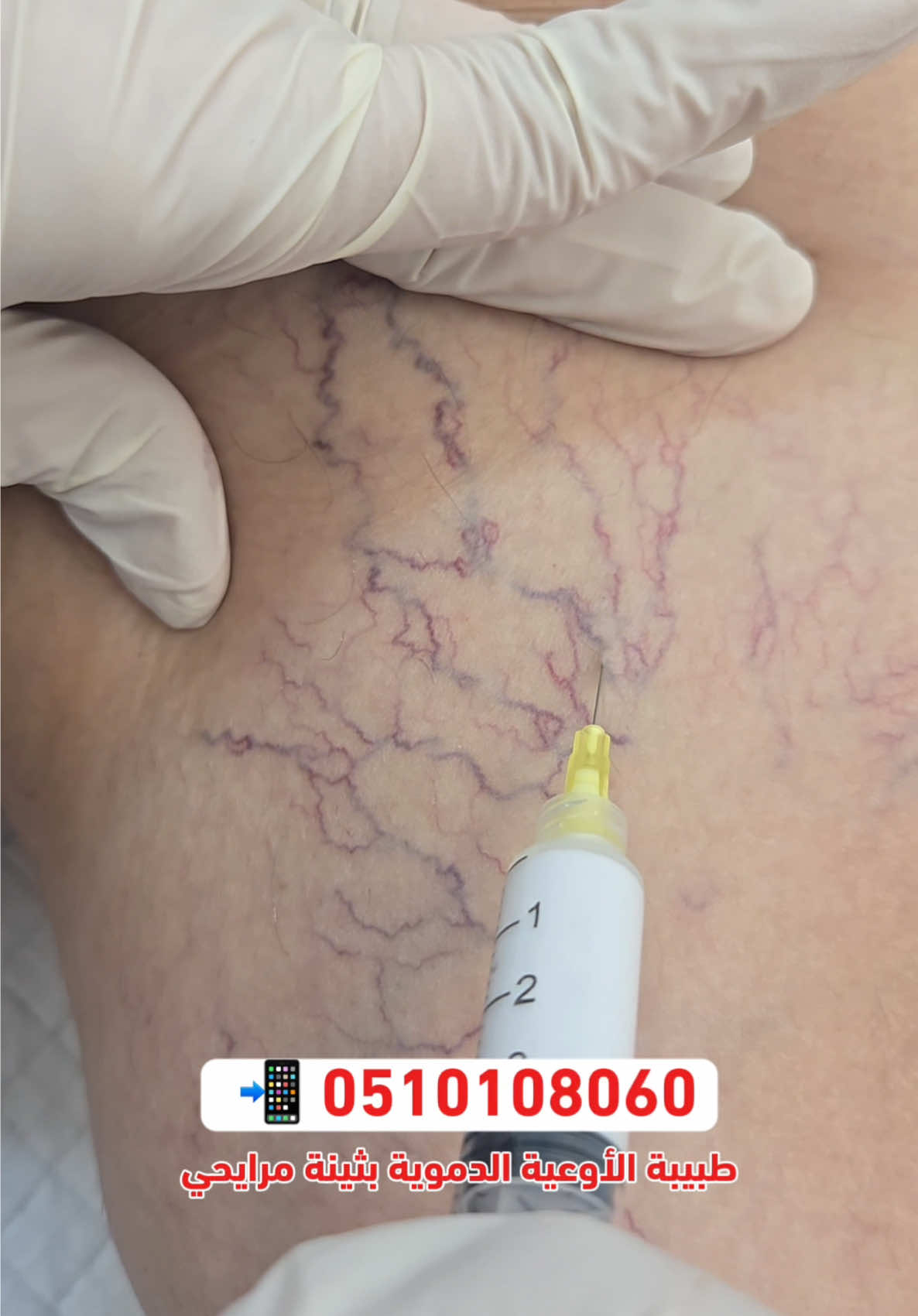 @عيادات سيجنتشر كير التخصصية