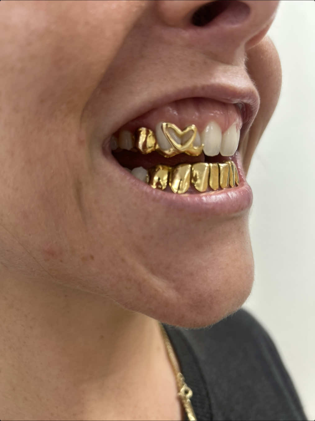 @LouieDaJewelryGuy