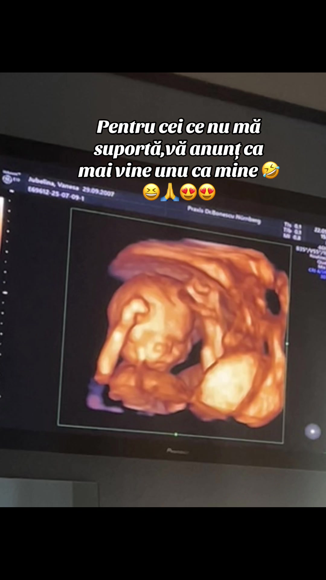 @28.mocanu