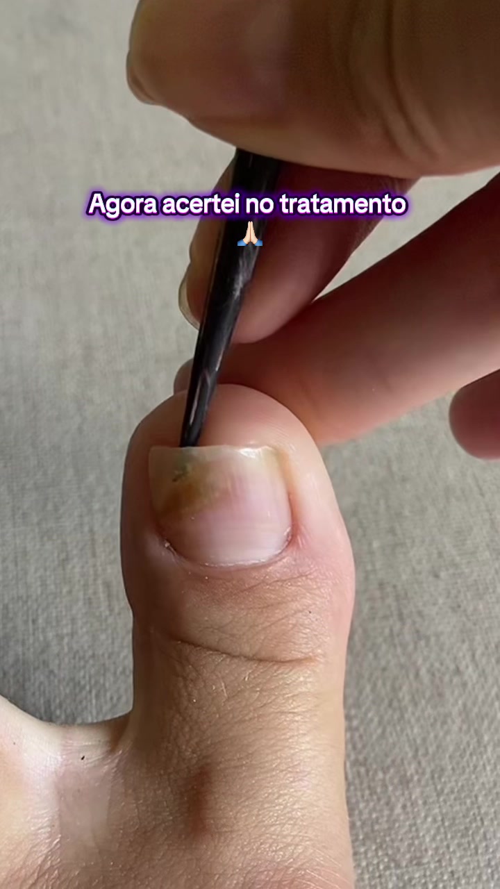 @Carolinaindica