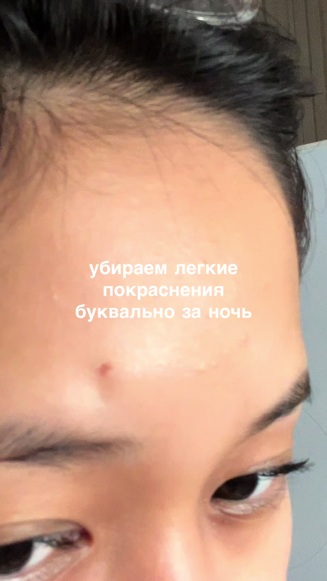 @ephiryn