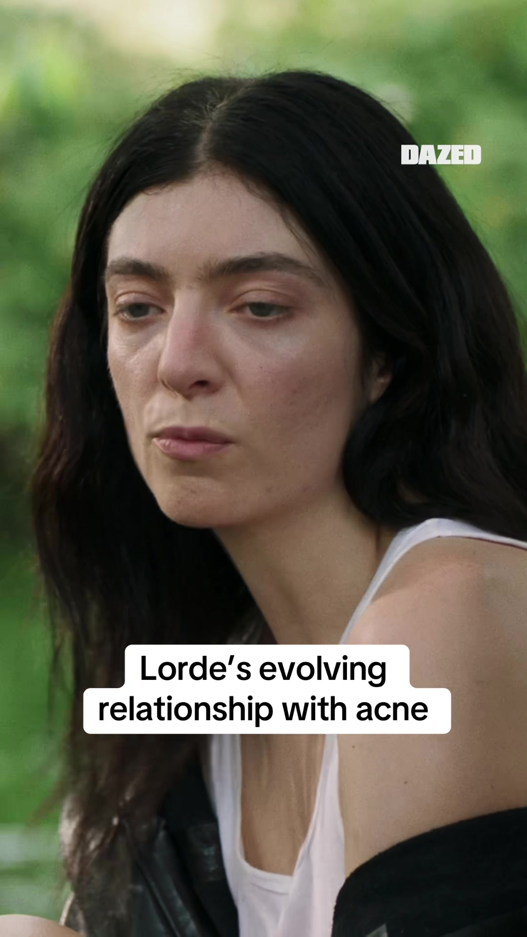 @dazed