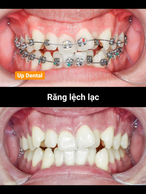 @Nha khoa niềng răng Up Dental