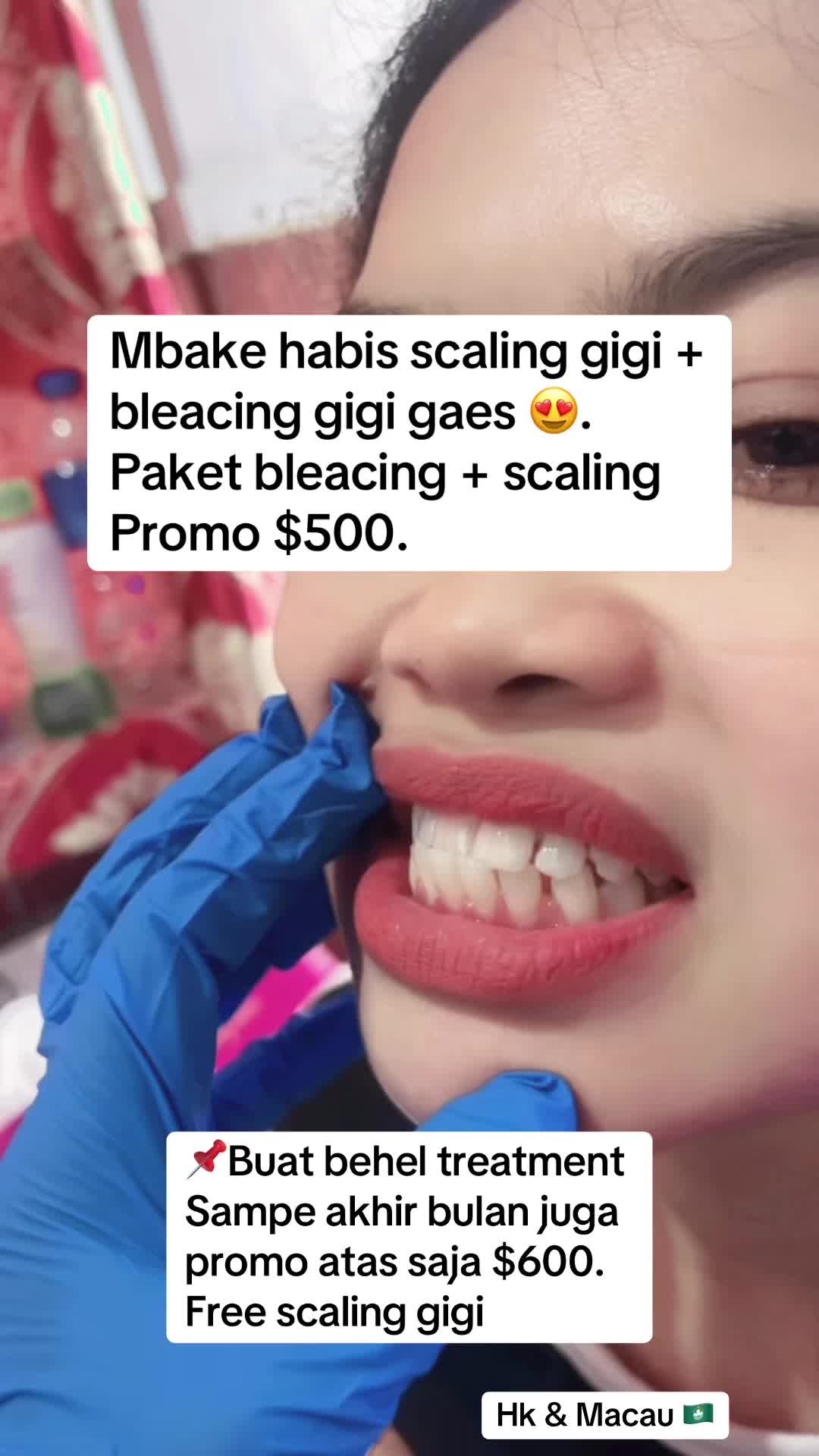@mbak-Paijem
