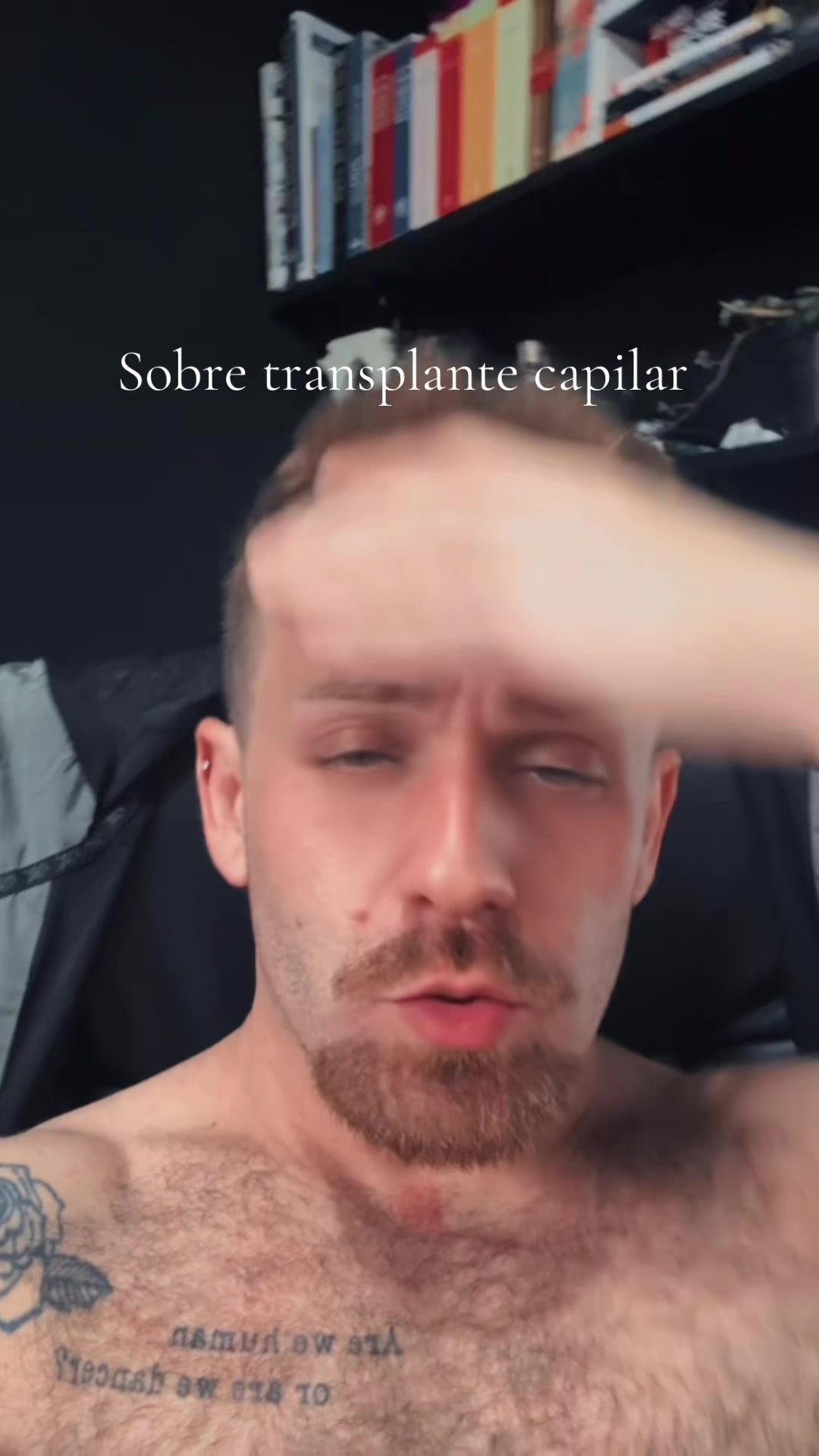 @Gustavo Essbich