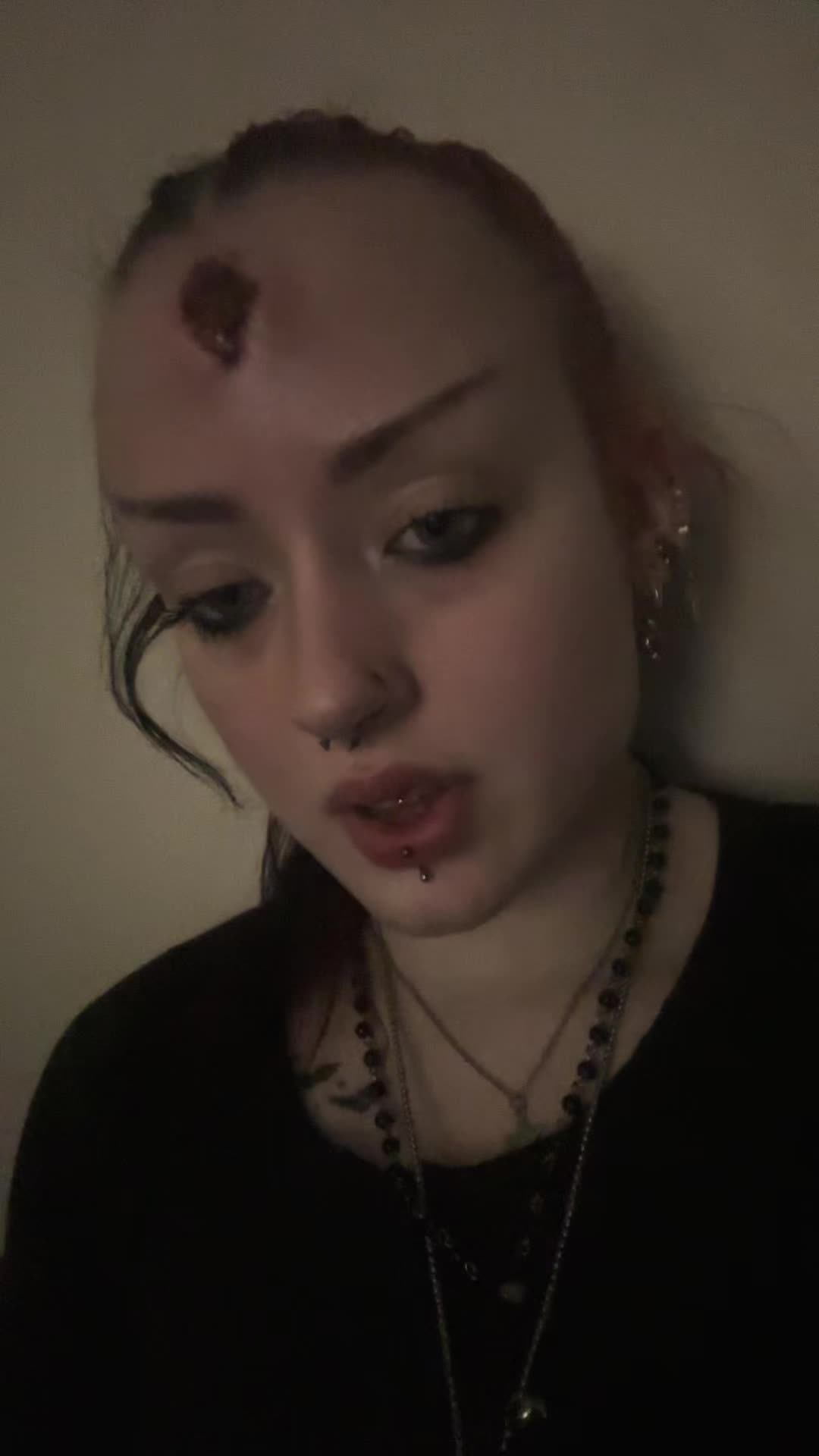 @katieseupdrecovery