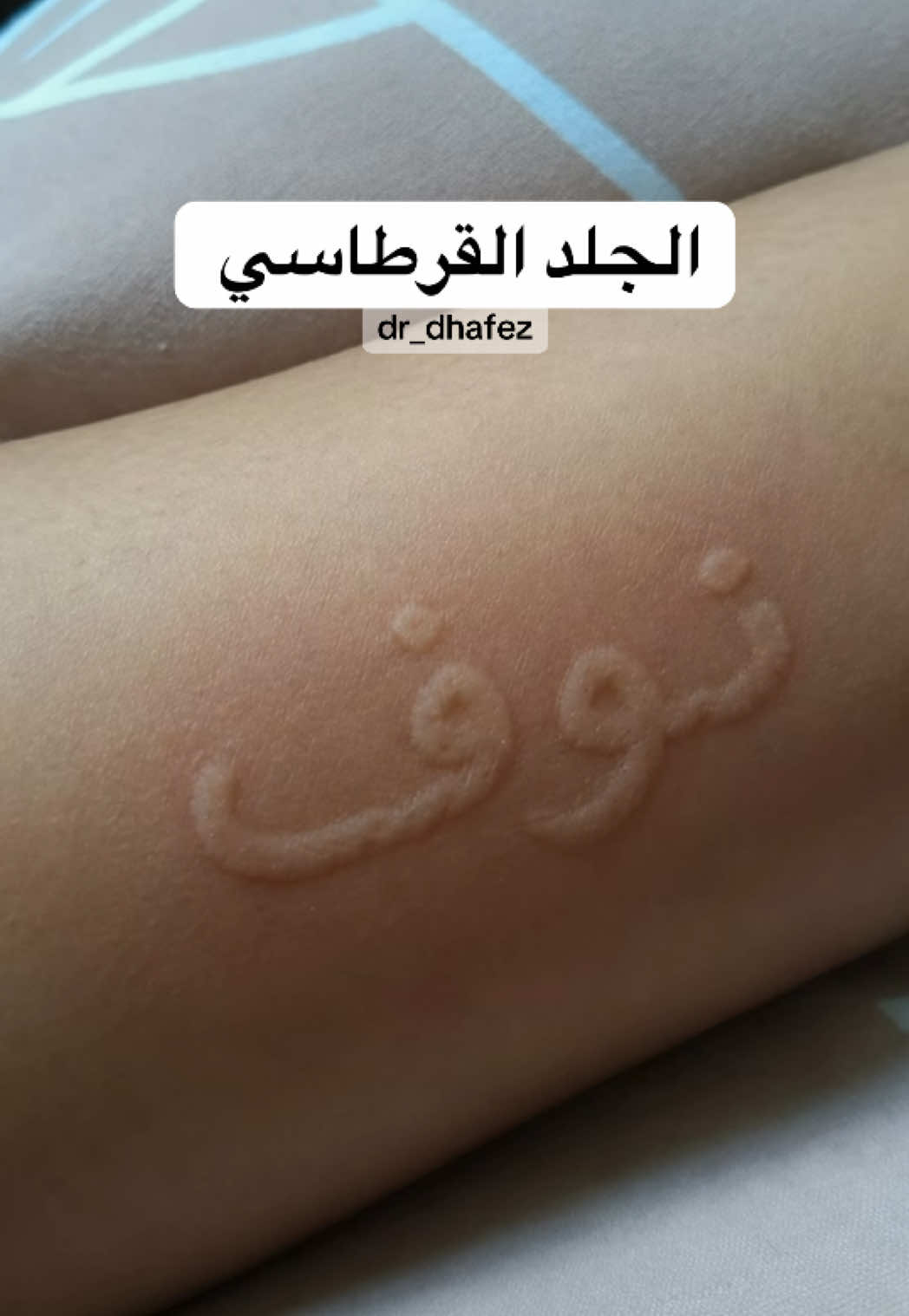 @د. ظافر آل حافظ