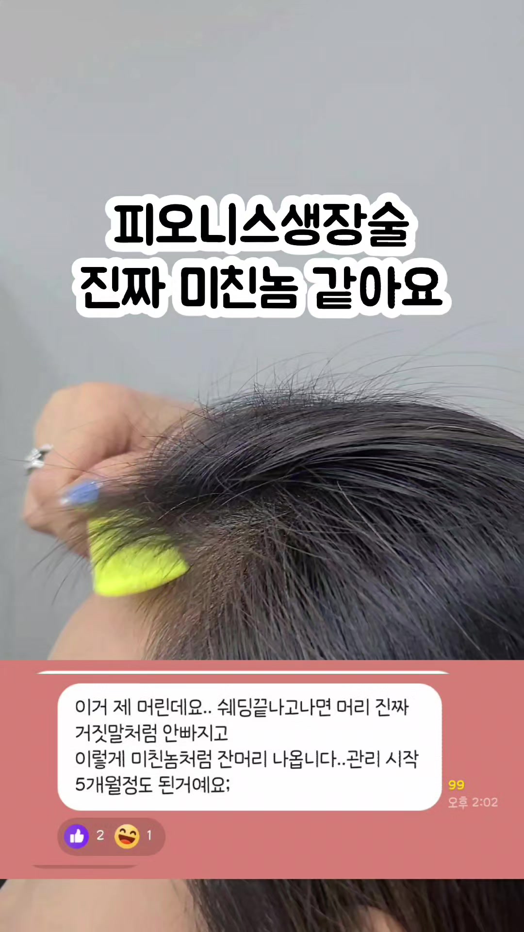 @슈엘