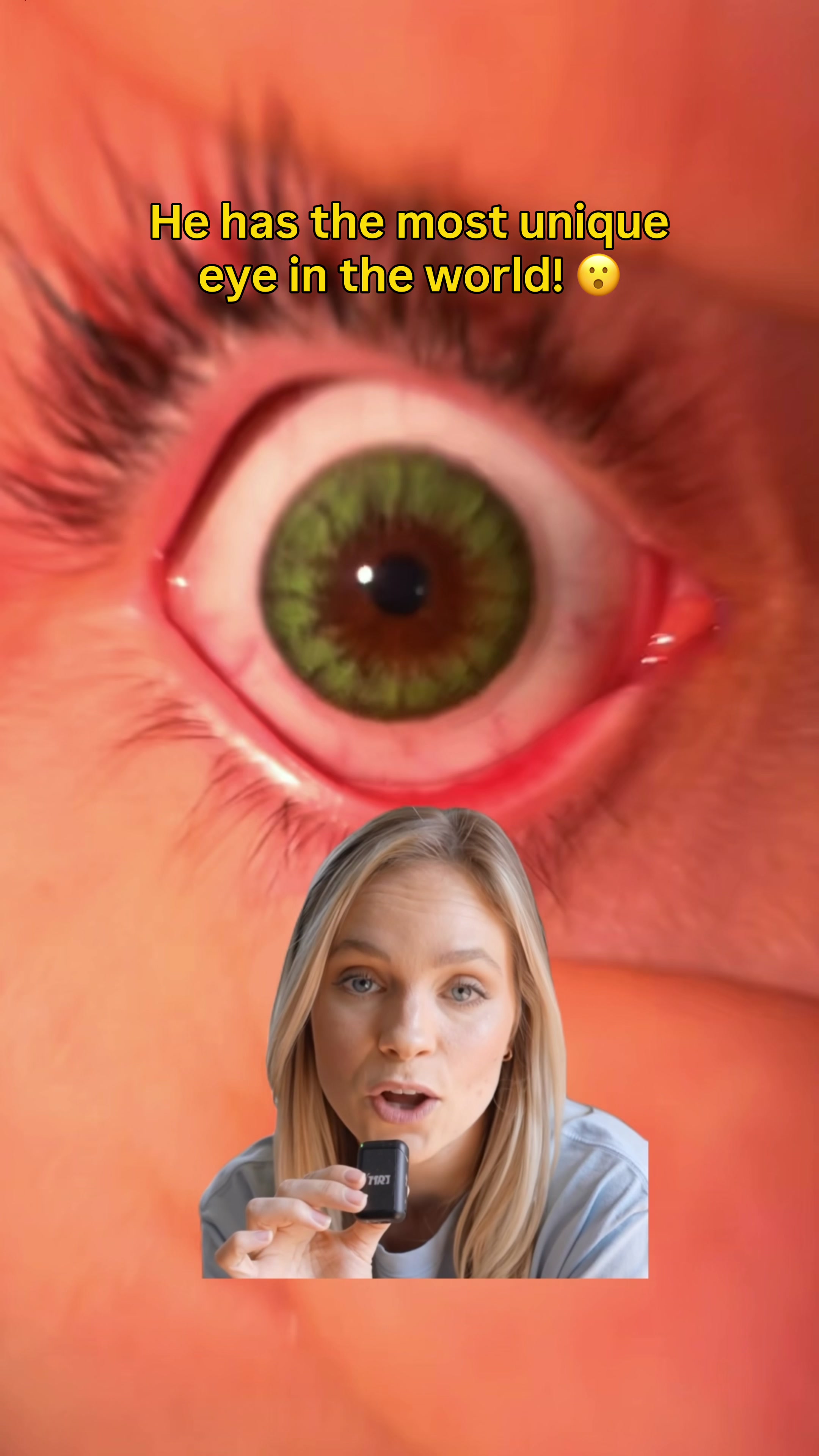 @Eyepic