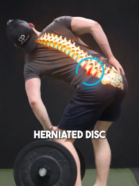 @Recover Pain