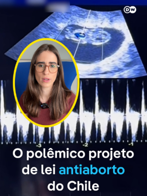 @DW Brasil