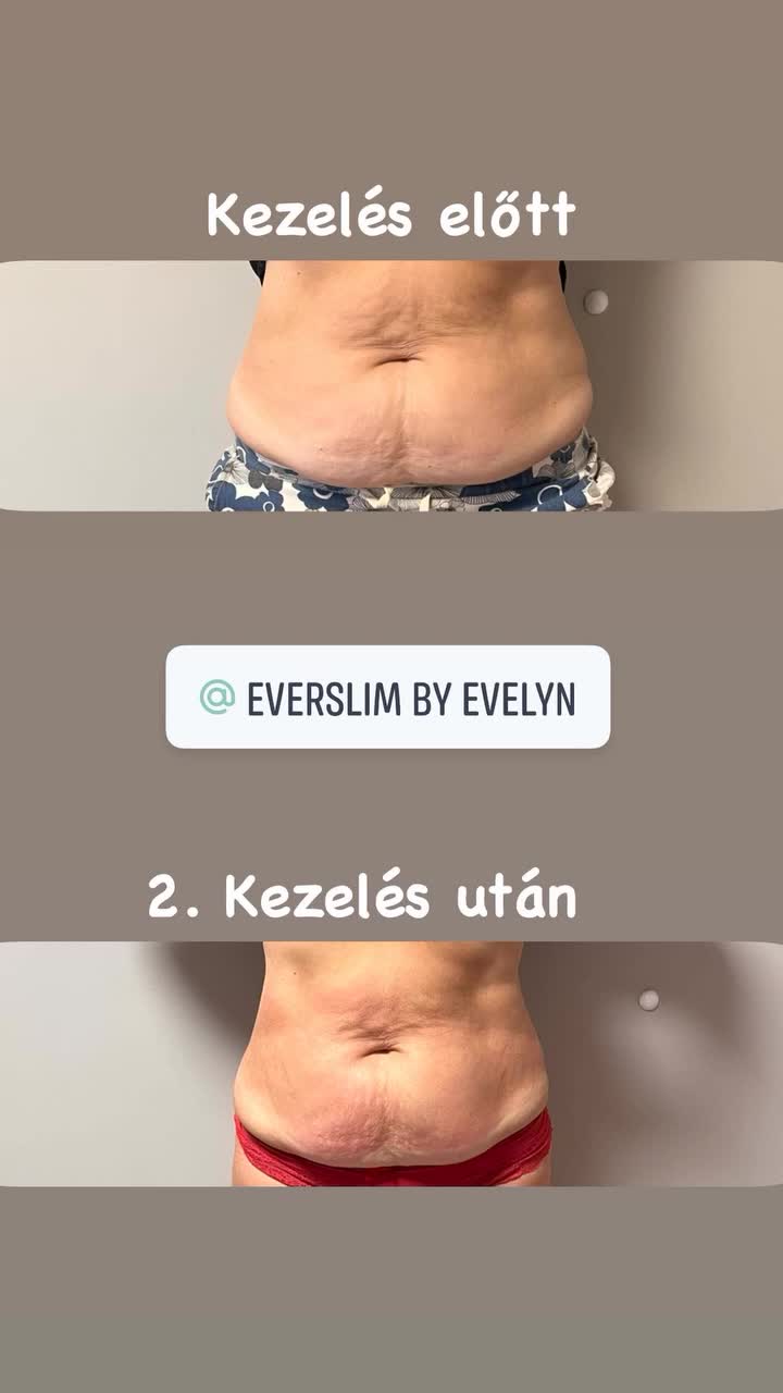 @EverSlim by Evelyn🌸