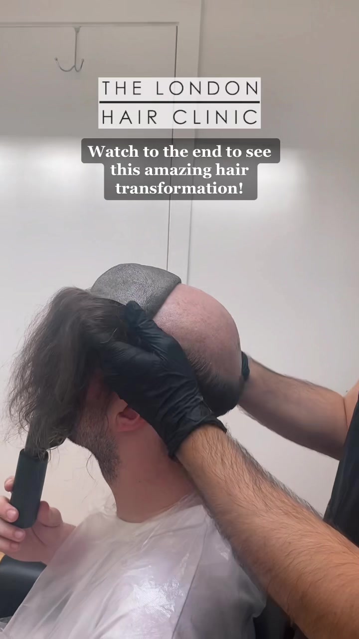 @TheLondonHairClinic