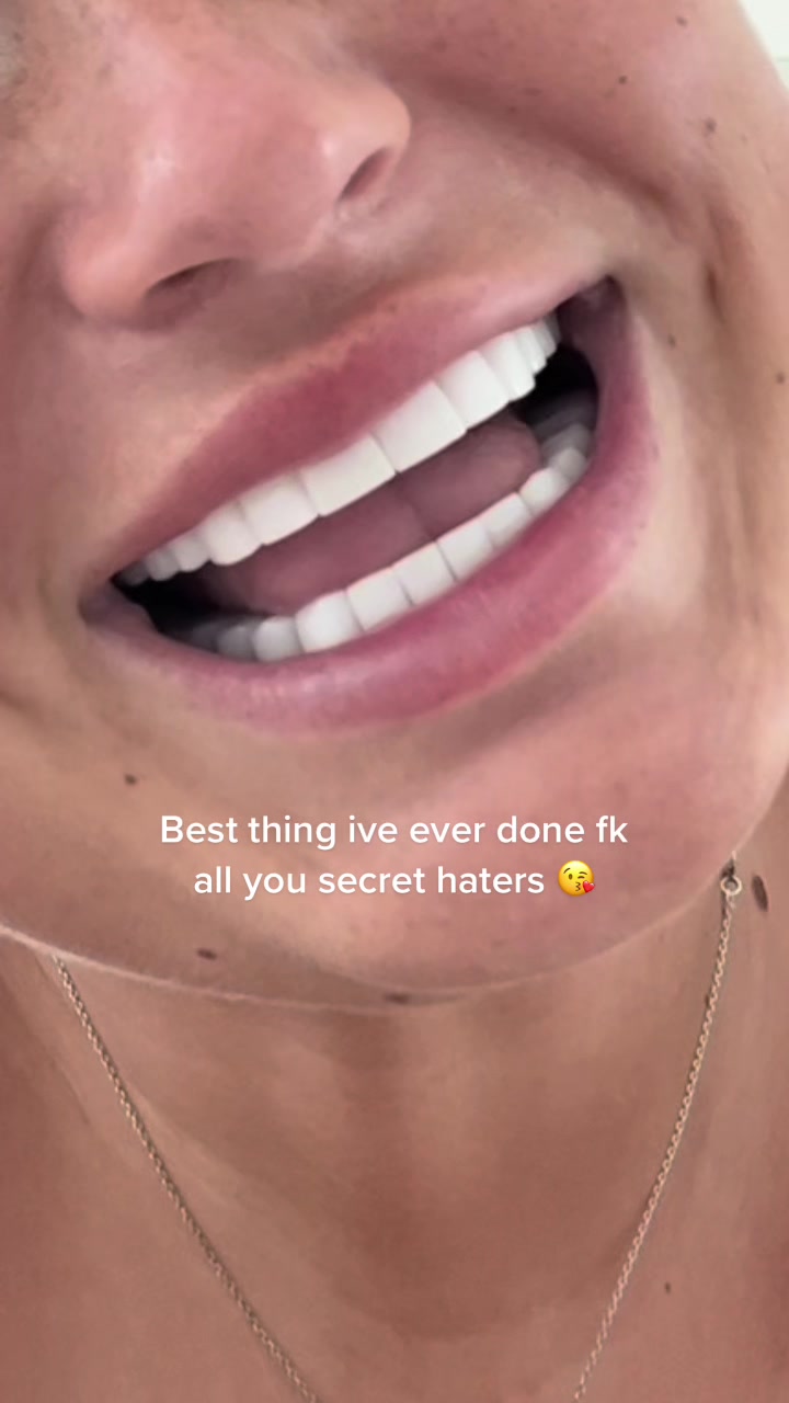 @𝐂𝐚𝐬𝐞𝐲 𝐉𝐚𝐢𝐧𝐞
