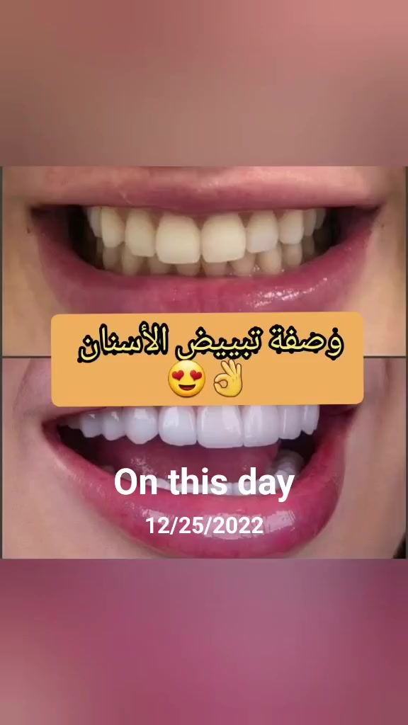 @still . Nouna