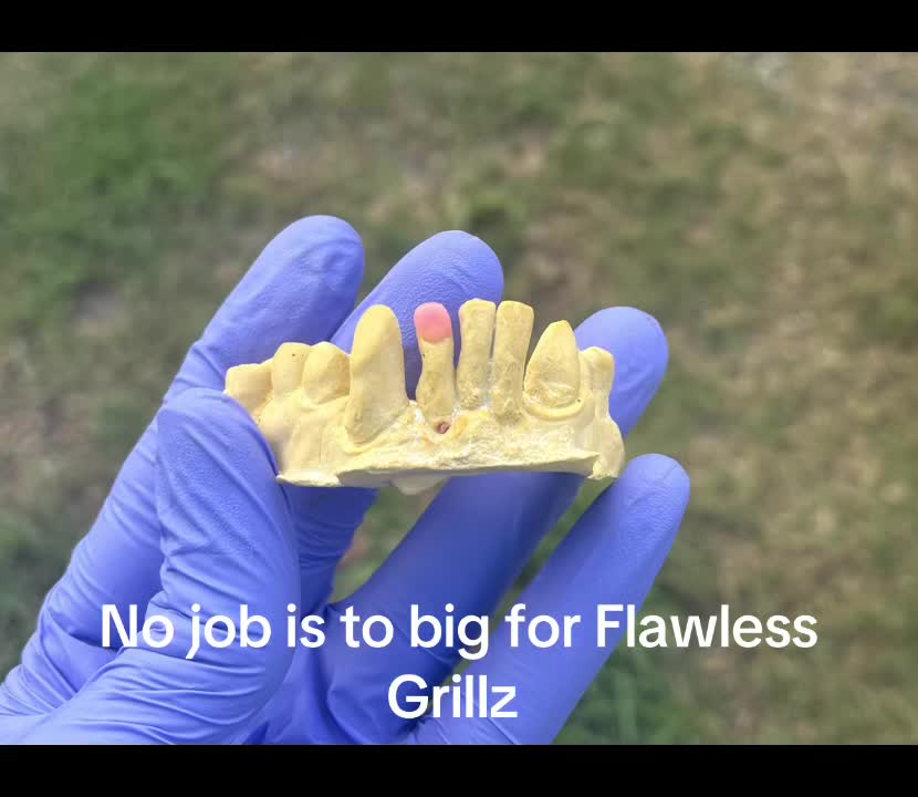 @Flawless Grillz