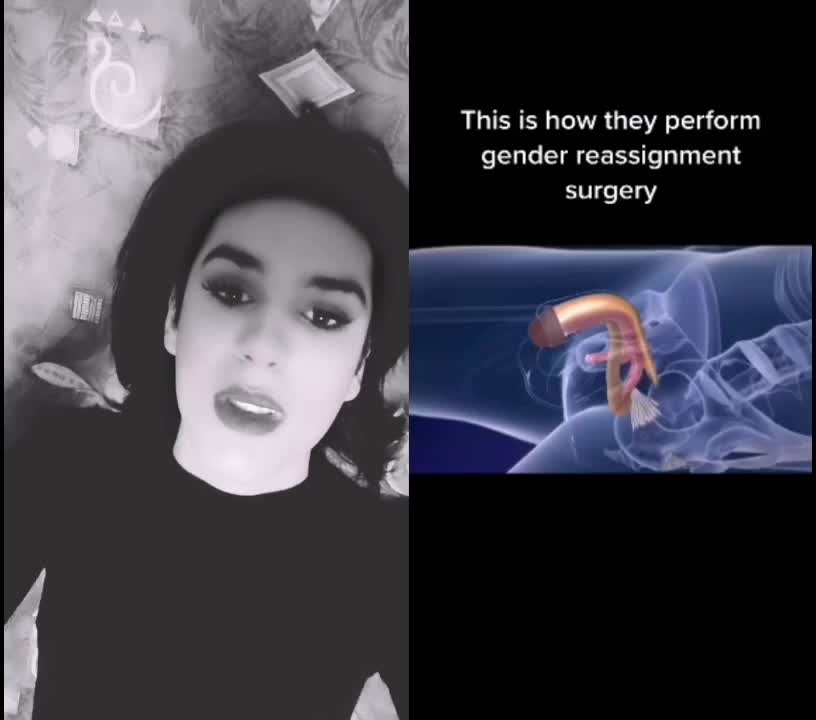 @Stella