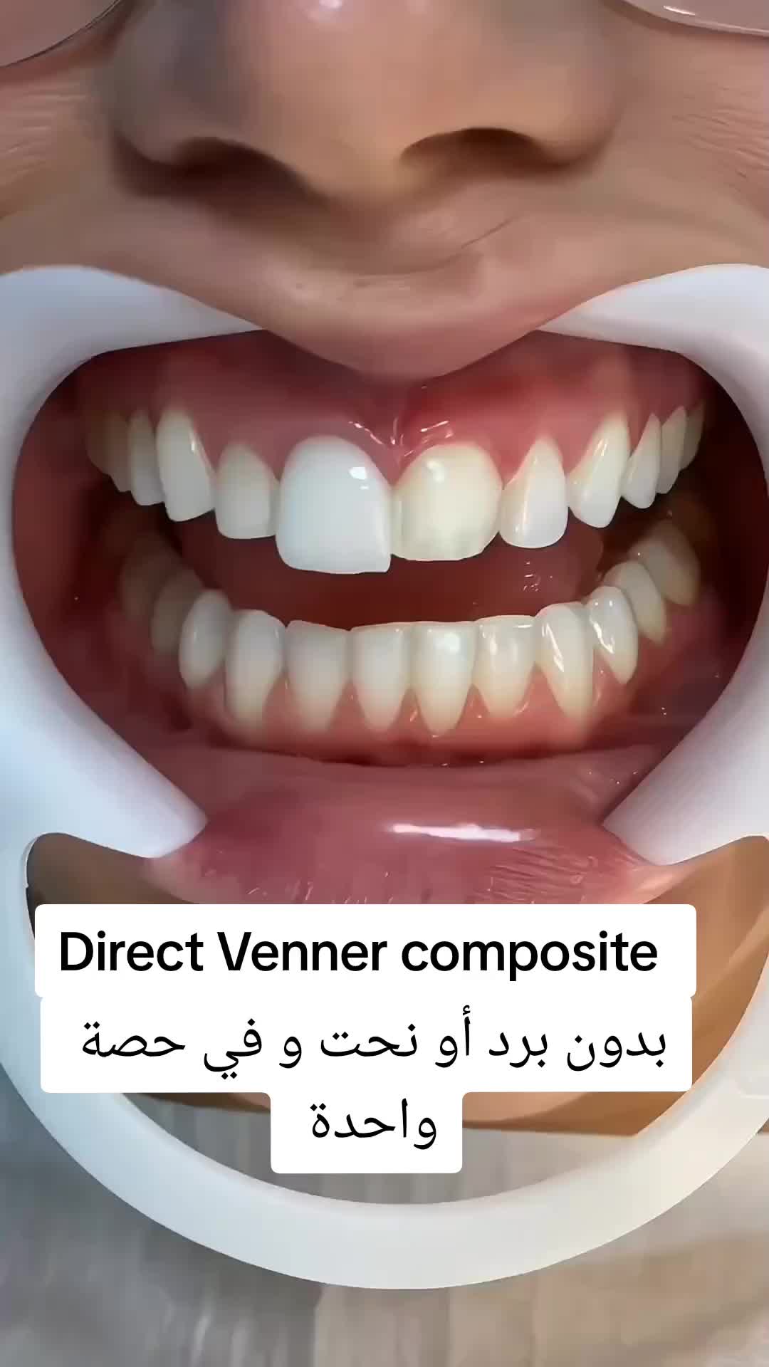 @brightsmileee1