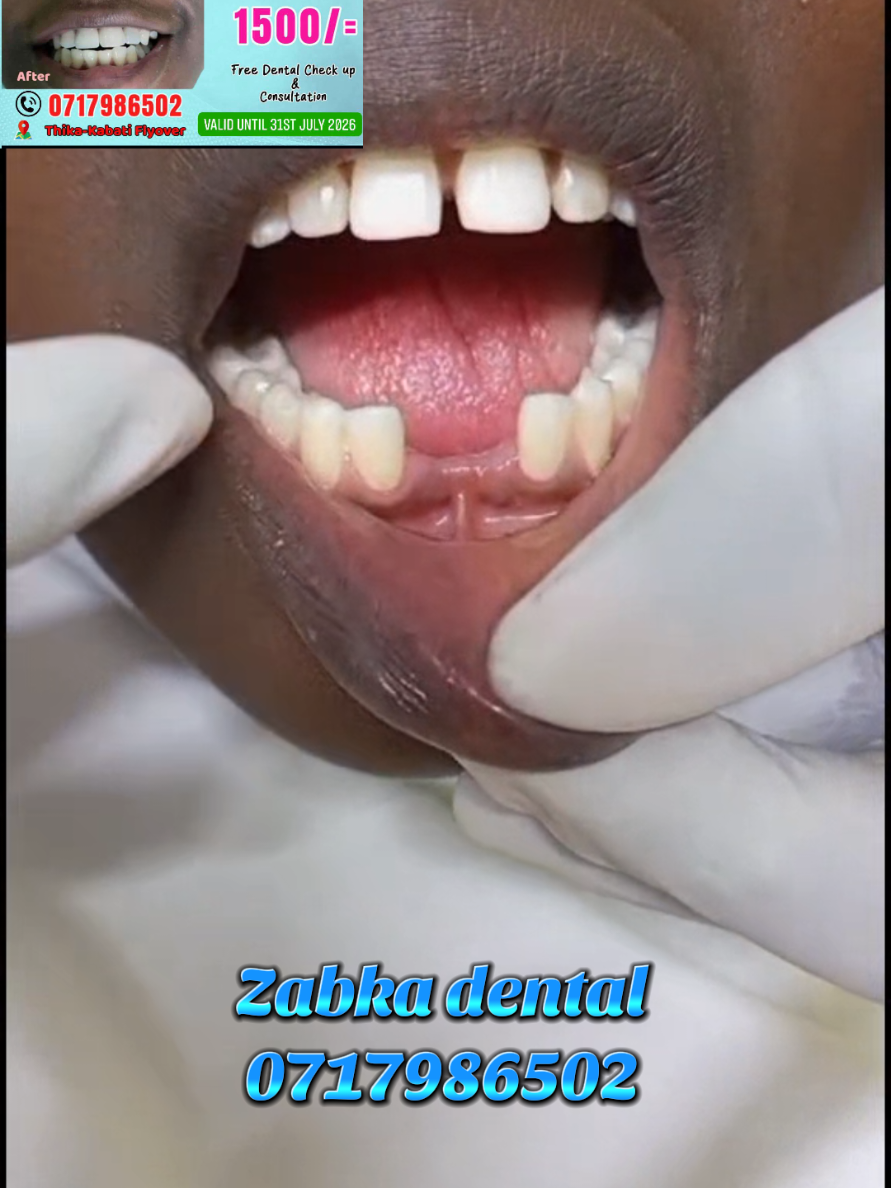 @Zabka Dental